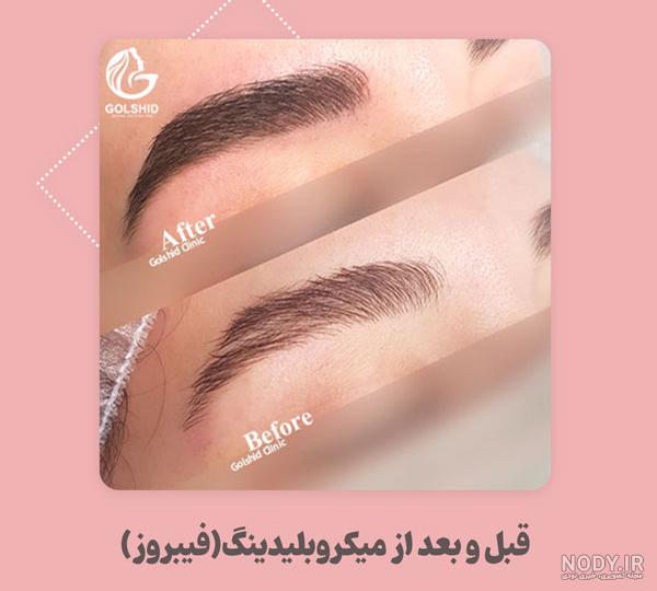 عکس تست حاملگی نیکا فلاحی