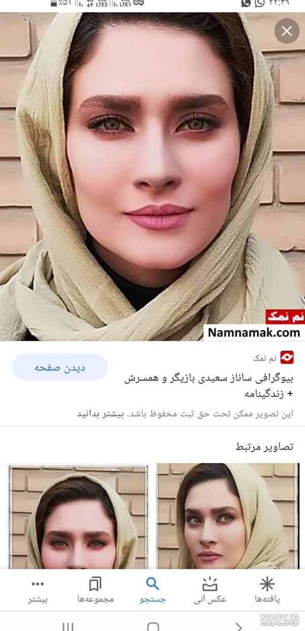 ساناز سعیدی قبل از عمل گونه