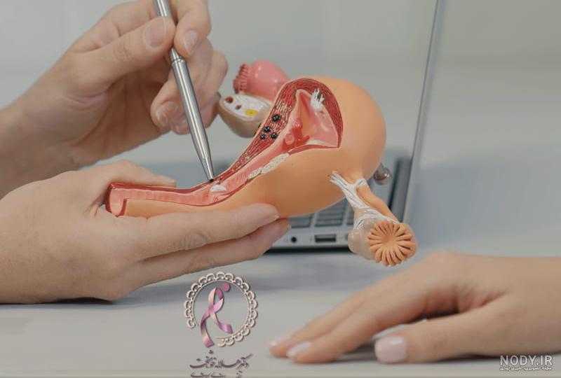 عکس رحم طبیعی