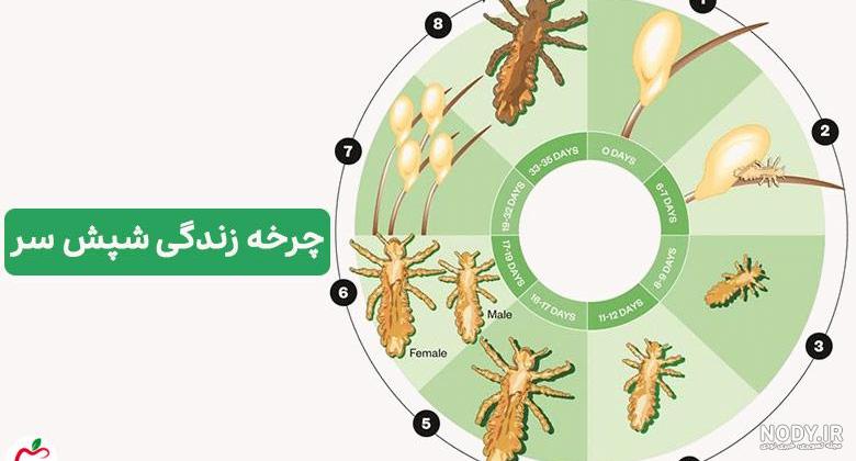 عکس شپش سر کودکان
