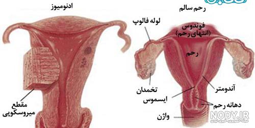 فیلم عمل کورتاژ