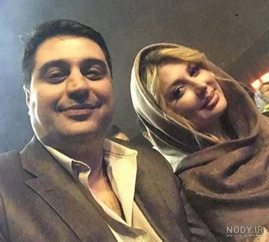 نیوشا ضیغمی قبل از عمل نیوشا ضیغمی قبل از عمل