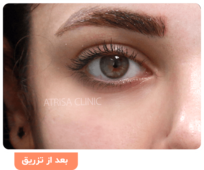 عکس چشم مشکی