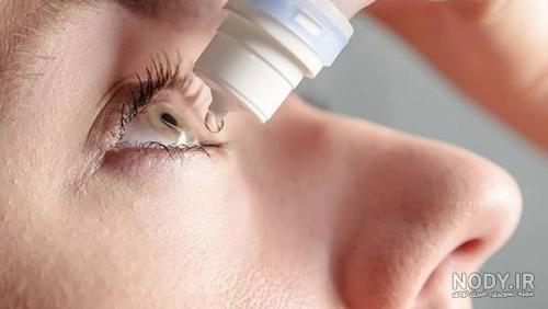 قرمزی چشم در قرمزی چشم در