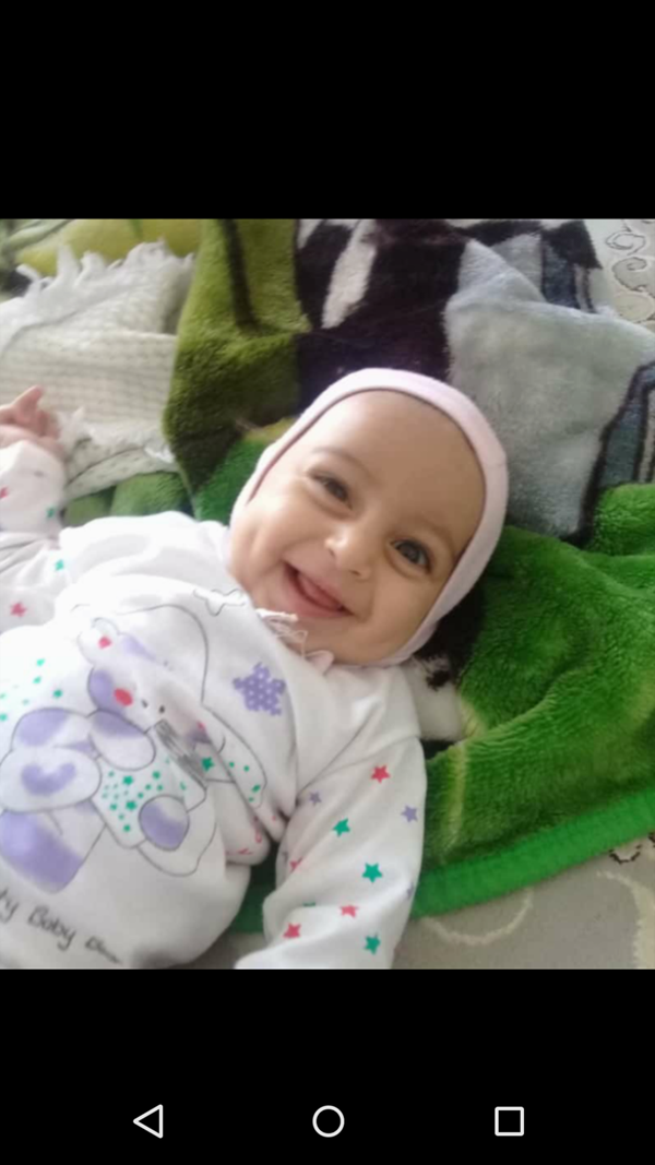 عکس پسر بچه چال گونه دار
