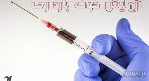 عکس جواب آزمایش بارداری مثبت ضعیف عکس جواب آزمایش بارداری مثبت ضعیف