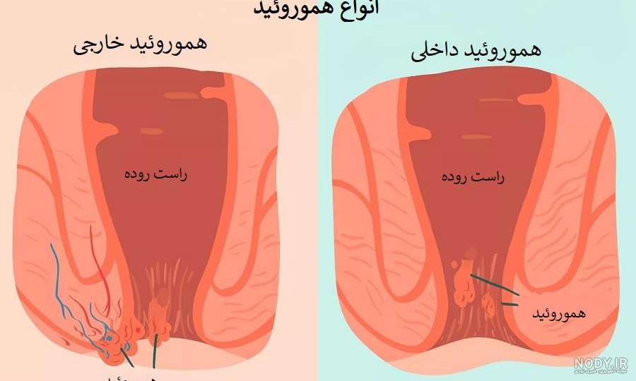 عکس قطره خون انسان عکس قطره خون انسان