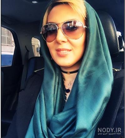 عکس لیلا بلوکات قبل از عمل عکس لیلا بلوکات قبل از عمل