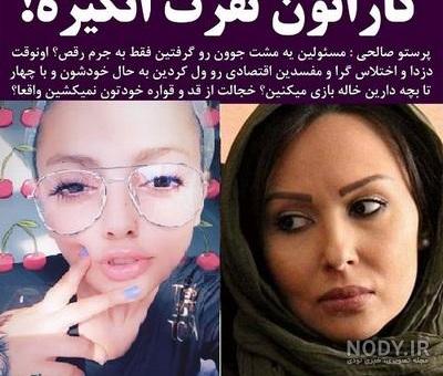 الناز قاسمی قبل از لاغری الناز قاسمی قبل از لاغری