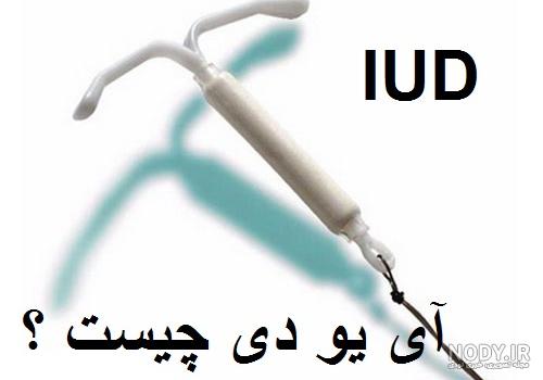 عکس آئودی در ایران