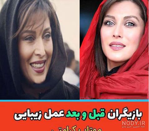عکس نیوشا ضیغمی قبل از عمل جراحی بینی