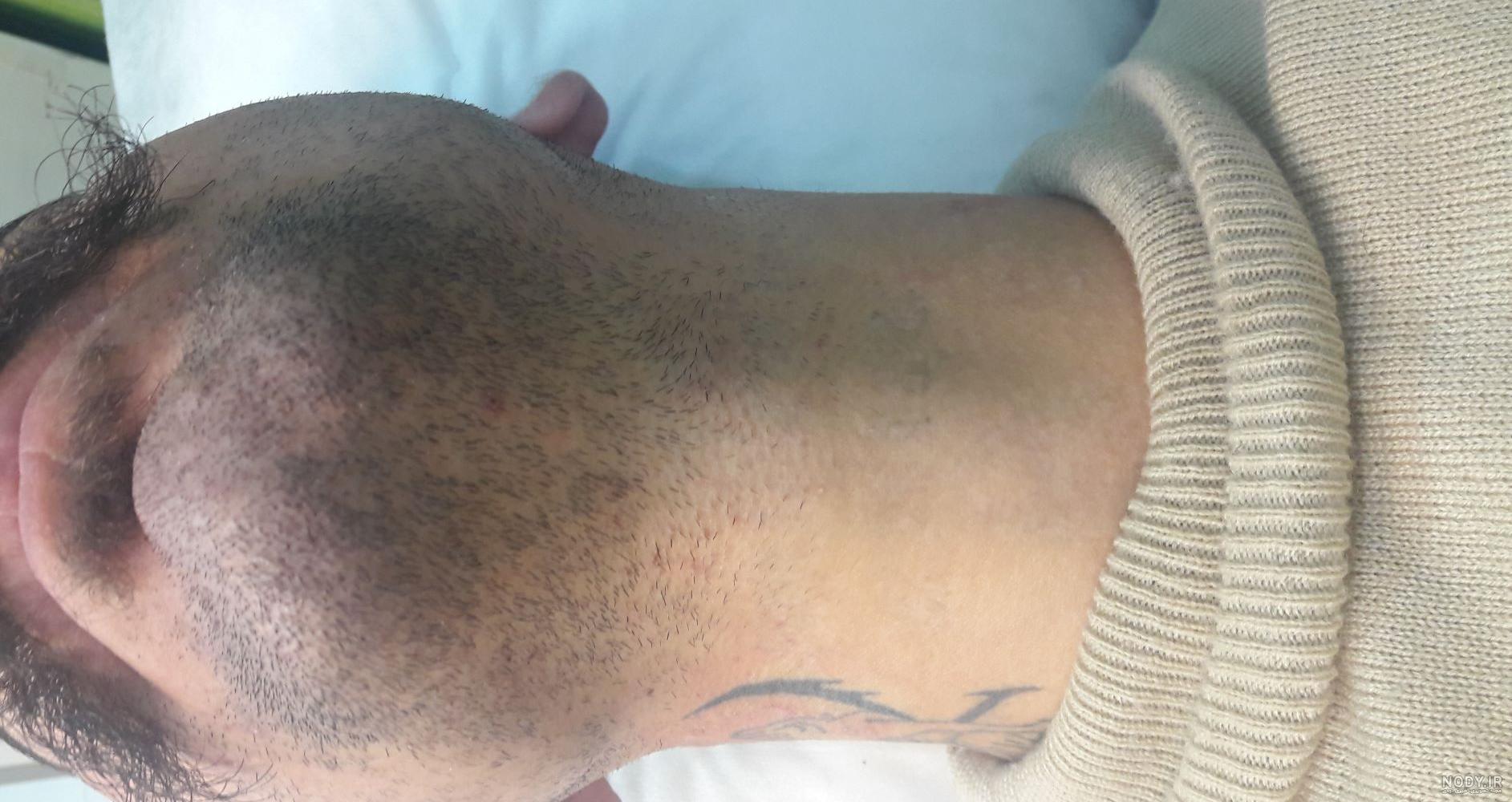 طرح تاتو روي سينه مرد