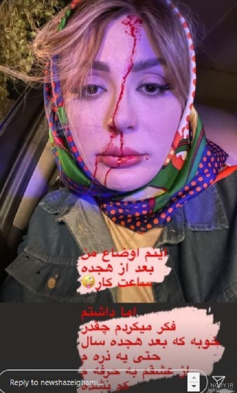 عکس نیوشا ضیغمی بدون گریم