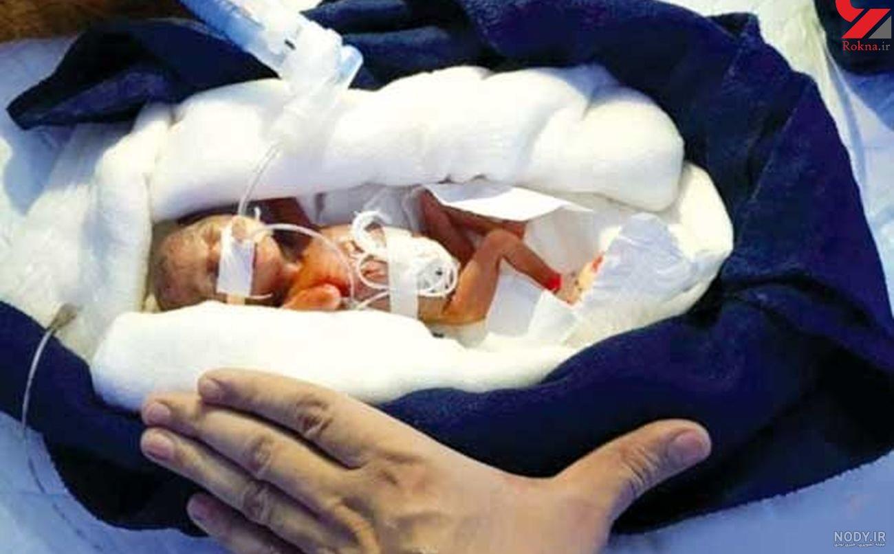 عکس به دنیا آمدن بچه
