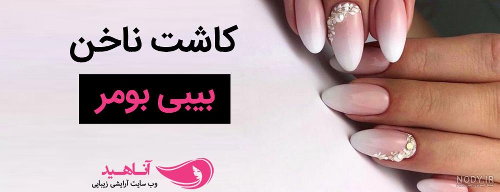 بیبی بومر هلویی کاشت
