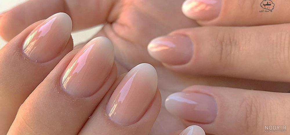 کاشت ناخن هلویی اکلیلی