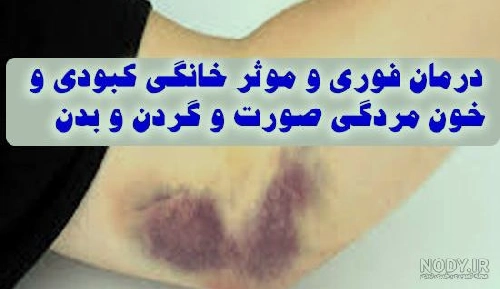 عاشقانه عکس کبودی گردن برای پروفایل عاشقانه عکس کبودی گردن برای پروفایل