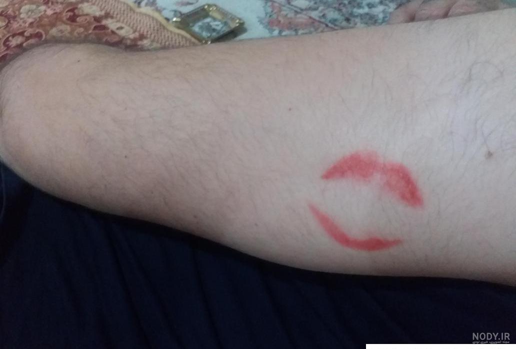 عکس عاشقانه گردن کبود عکس عاشقانه گردن کبود