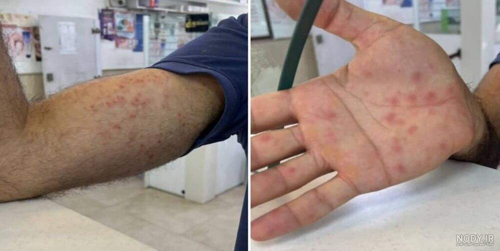 تصویر ابله میمونی