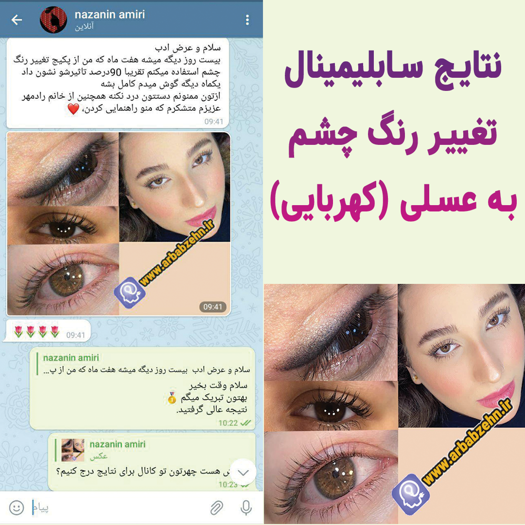چشم عسلي