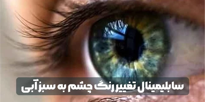 چشمان سبز