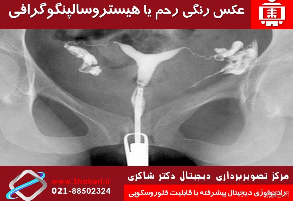 عکس رنگی رحم با بیهوشی عکس رنگی رحم با بیهوشی
