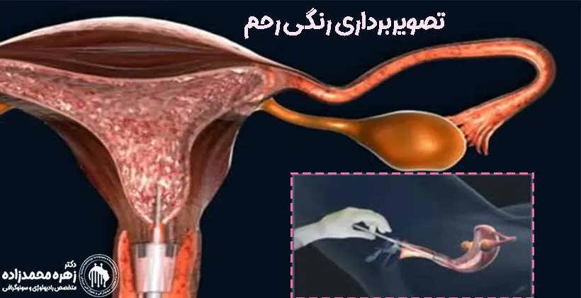 عکس رنگی رحم و بارداری عکس رنگی رحم و بارداری