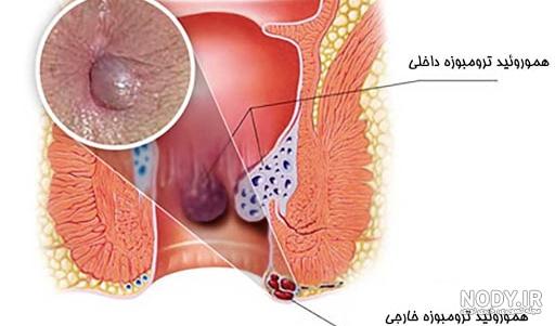 از