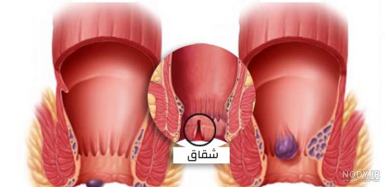 بعد