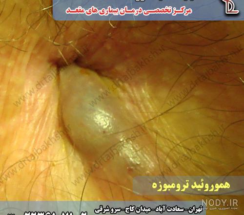 طبیعی