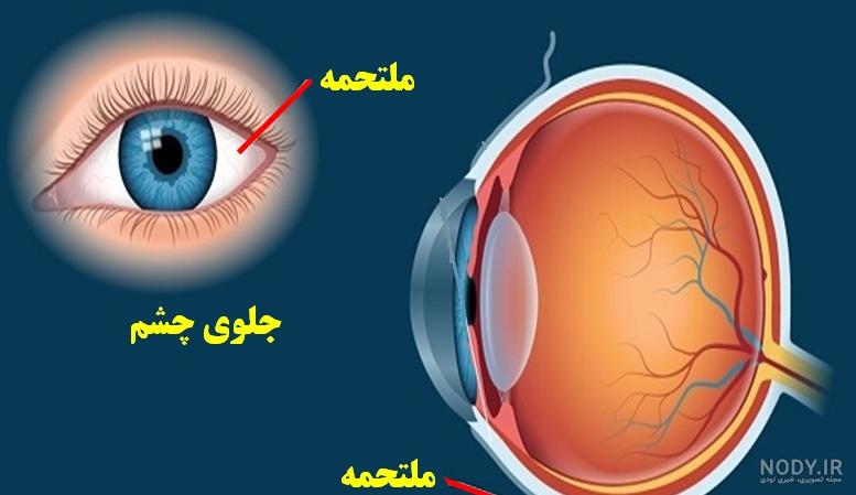 چشمی چشمی