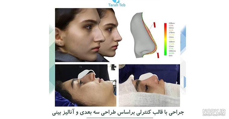 وازلین