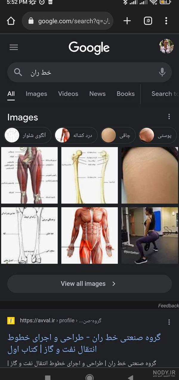 كبودي ران پا كبودي ران پا