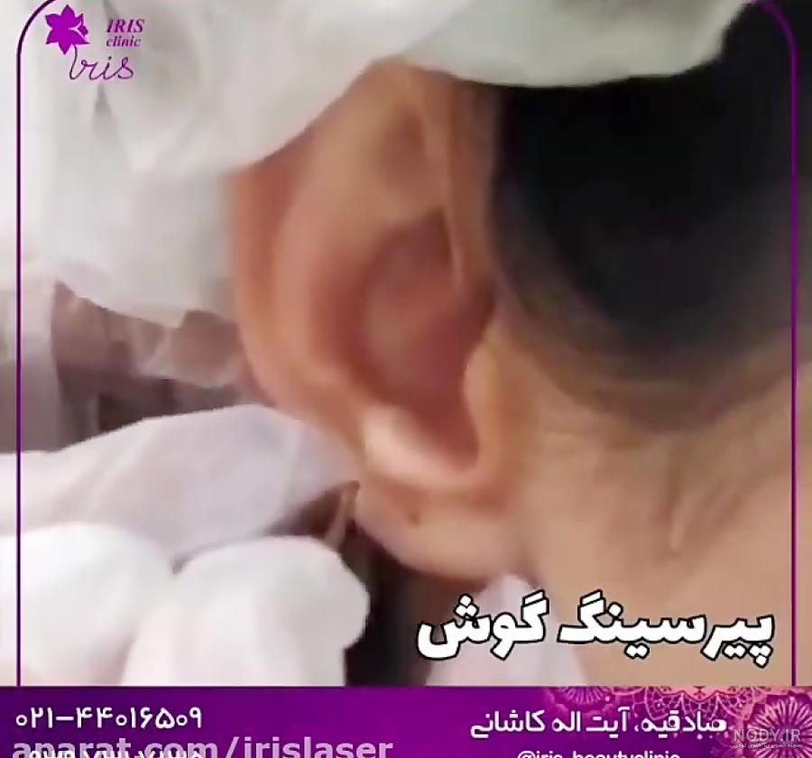 پرسينگ ناف