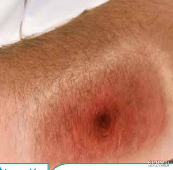 عکس سیاه زره ی مرموز عکس سیاه زره ی مرموز