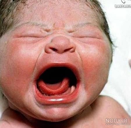 عکس بچه زشت دختر عکس بچه زشت دختر