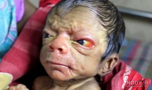 عکس بچه زشت نوزاد عکس بچه زشت نوزاد