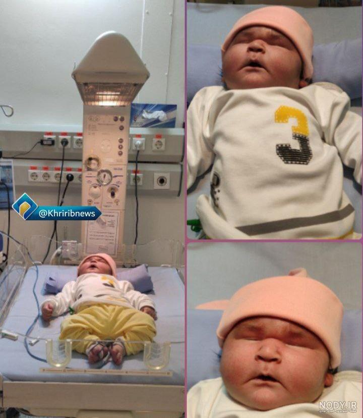 عکس نوزاد هفت کیلویی در مشهد