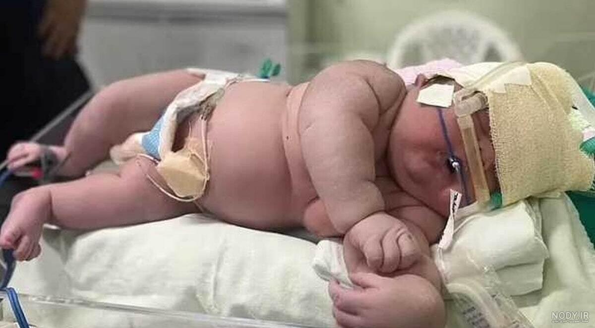 عکس نوزاد هفت کیلویی در مشهد امروز