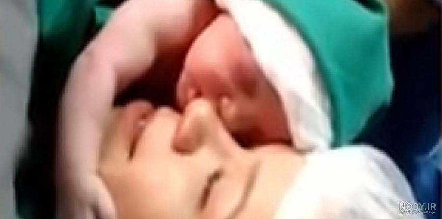 عکس نوزاد تازه متولد شده دختر و پسر بامزه خوشگل 👶 + نکات و ...
