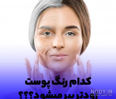 چگونه با سیب زمینی پوستمان را سفید کنیم؟ چگونه با سیب زمینی پوستمان را سفید کنیم؟