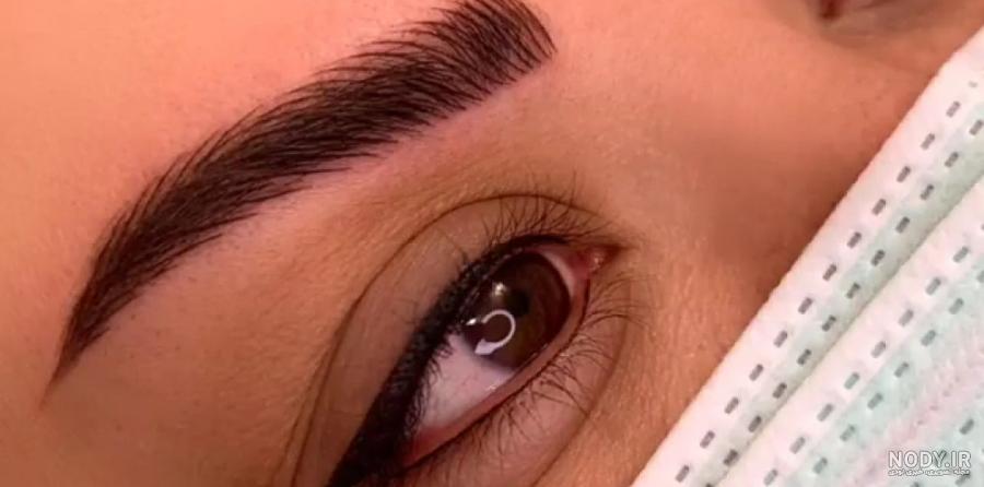 بن مژه چیست ؟ عکس بن مژه قبل و بعد