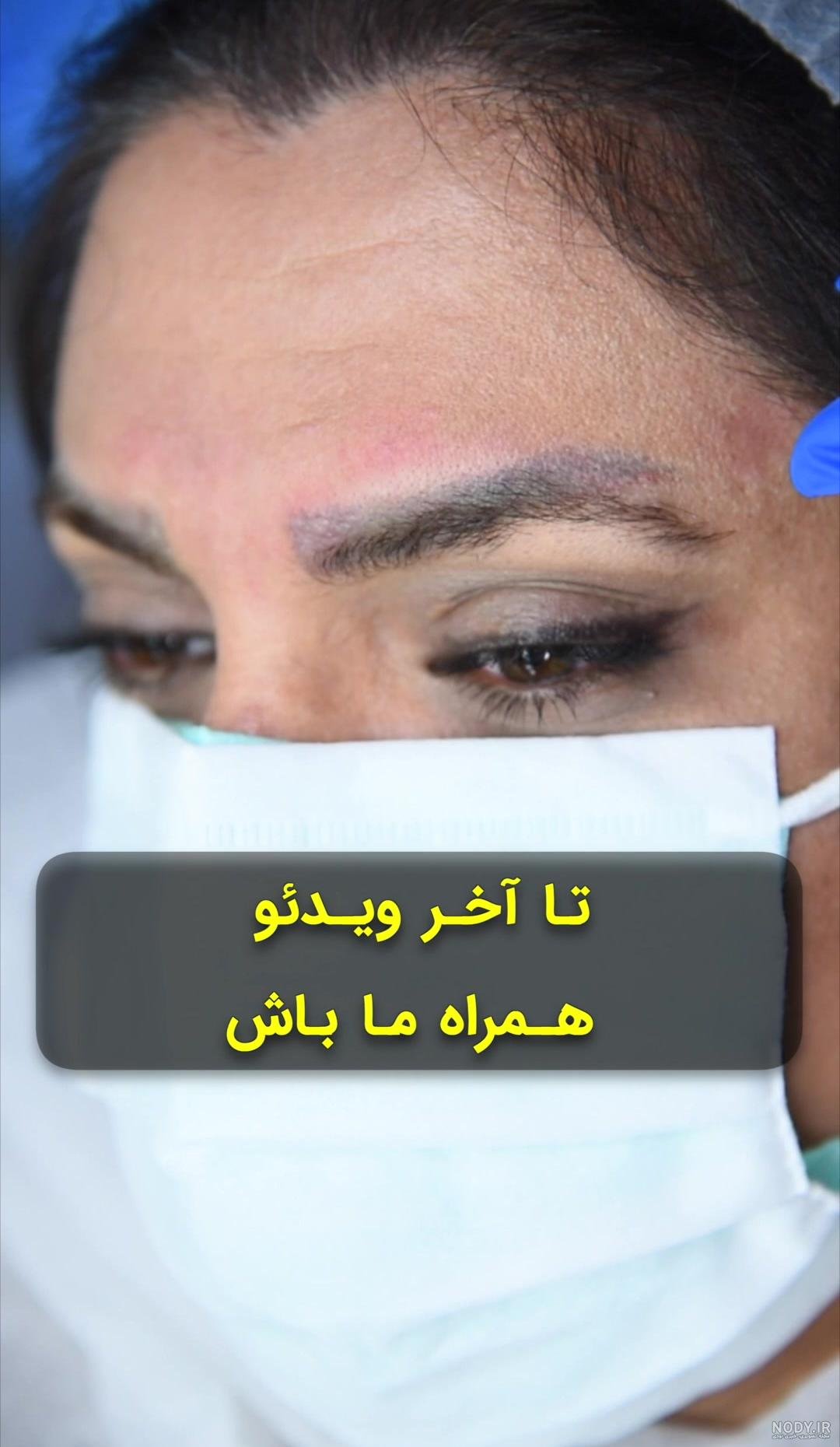 عکس چشم بن مژه - عکس نودی