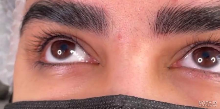 عکس کاشت بن مژه - عکس نودی