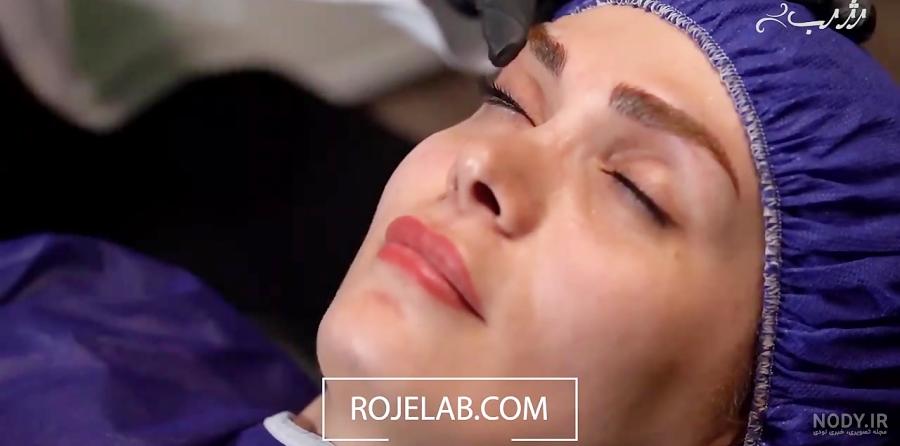 عکس کاشت بن مژه - عکس نودی