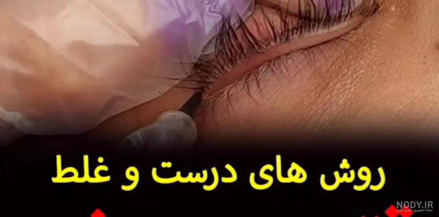 عکس کاشت بن مژه - عکس نودی