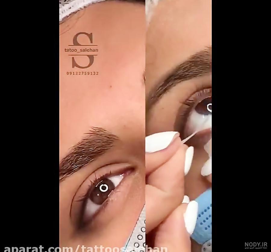عکس کاشت بن مژه - عکس نودی