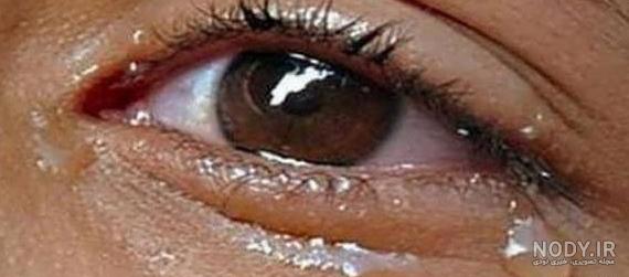 عکس پروفایل دخترونه چشم قهوه ای