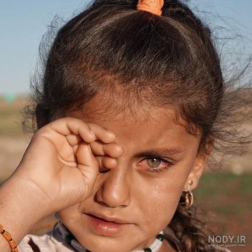 دانلود عکس چشم گریان دختر - کامل (مولیزی)