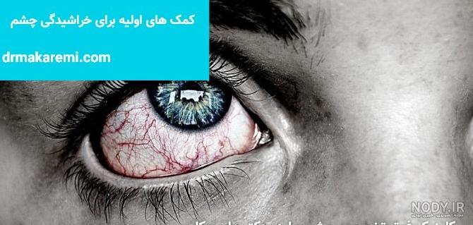 عکس برای پروفایل چشم زخم عکس برای پروفایل چشم زخم
